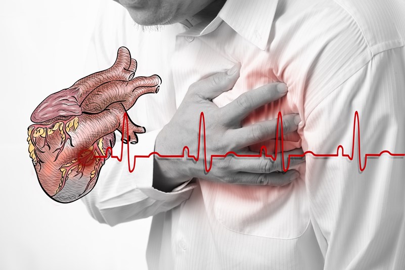atacul de cord sau infarctul miocardic